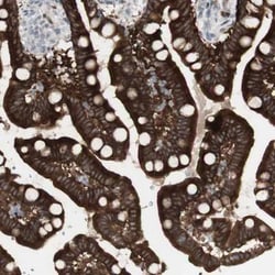 SARG Antibody, Novus Biologicals 0.1mL; Unlabeled:Antibodies, Polyclonal