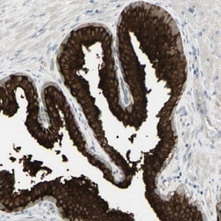 SARG Antibody, Novus Biologicals 0.1mL; Unlabeled:Antibodies, Polyclonal
