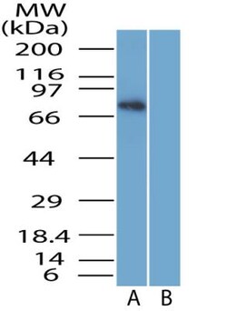 SARM1 Antibody - BSA Free, Novus Biologicals 0.1mg; Unlabeled:Antibodies,
