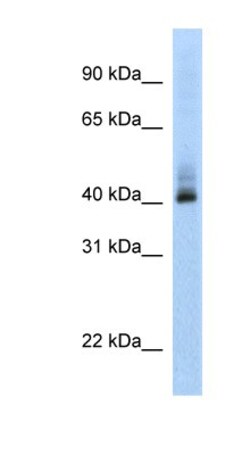 SARP Antibody, Novus Biologicals 100&mu;L; Unlabeled:Antibodies, Polyclonal