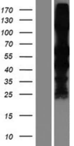 Novus Biologicals&trade;&nbsp;S-arrestin Overexpression Lysate