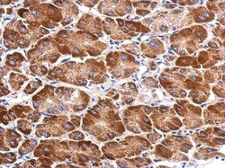 SARS2 Antibody, Novus Biologicals 0.1mL; Unlabeled:Antibodies, Polyclonal
