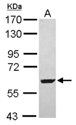 SARS2 Antibody, Novus Biologicals 0.1mL; Unlabeled:Antibodies, Polyclonal
