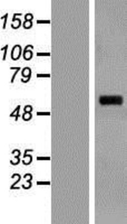 Novus Biologicals&trade;&nbsp;SARS2 Overexpression Lysate