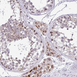SARS2 Antibody, Novus Biologicals:Antibodies:Primary Antibodies