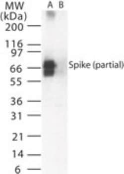 SARS Spike Protein Antibody, Novus Biologicals 0.1 mg | Buy Online | Novus Biologicals | Fisher Scientific