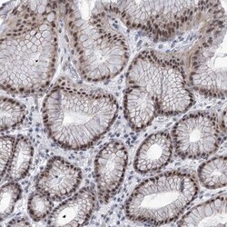 SART1 Antibody, Novus Biologicals 25 &mu;L; Unlabeled:Antibodies, Polyclonal