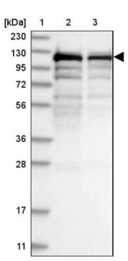 SART1 Antibody, Novus Biologicals 25 &mu;L; Unlabeled:Antibodies, Polyclonal