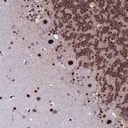 SART3 Antibody, Novus Biologicals 0.1mL; Unlabeled:Antibodies, Polyclonal