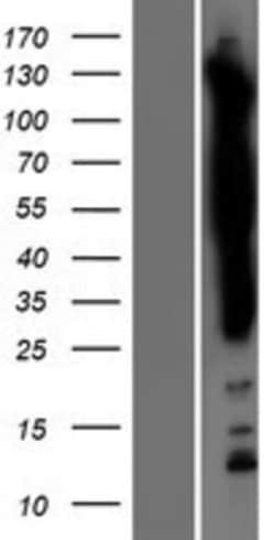 Novus Biologicals™ SASH1 Overexpression Lysate