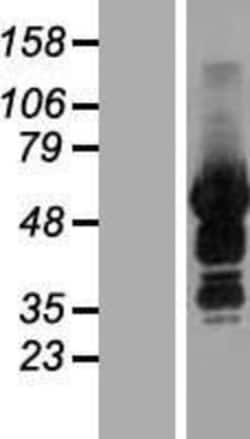 Novus Biologicals&trade;&nbsp;SASH3 Overexpression Lysate