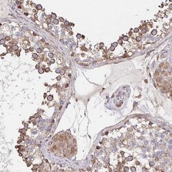 SAT1 Antibody, Novus Biologicals 25 &mu;L, Unlabeled:Antibodies, Polyclonal