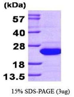 Novus Biologicals Recombinant Human SAT1 His Protein 0.1mg; Unlabeled | Buy Online | Novus Biologicals&trade; | Fisher Scientific