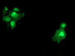SAT2 Antibody (OTI1C9), Novus Biologicals 0.1mL; Unlabeled:Antibodies,