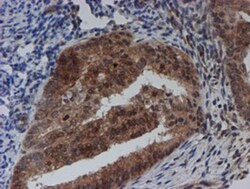 SAT2 Antibody (OTI1C9), Novus Biologicals 0.1mL; Unlabeled:Antibodies,