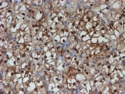 SAT2 Antibody (OTI1C9), Novus Biologicals 0.1mL; Unlabeled:Antibodies,
