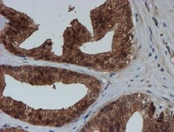 SAT2 Antibody (OTI1C9), Novus Biologicals 0.1mL; Unlabeled:Antibodies,
