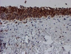 SAT2 Antibody (OTI1C9), Novus Biologicals 0.1mL; Unlabeled:Antibodies,