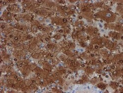 SAT2 Antibody (OTI1C9), Novus Biologicals 0.1mL; Unlabeled:Antibodies,