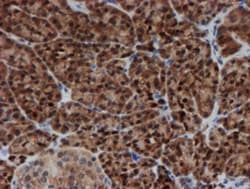 SAT2 Antibody (OTI1C9), Novus Biologicals 0.1mL; Unlabeled:Antibodies,