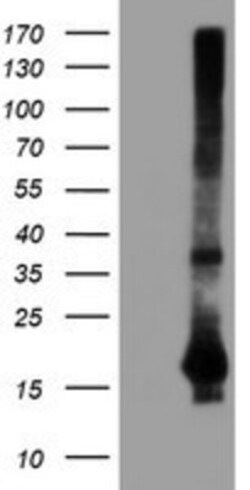 SAT2 Antibody (OTI1C9), Novus Biologicals 0.1mL; Unlabeled:Antibodies,