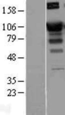 Novus Biologicals&trade;&nbsp;SATB1 Overexpression Lysate