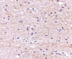 SATB2 Antibody - BSA Free, Novus Biologicals 0.1mg; Unlabeled:Antibodies,
