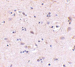 SATB2 Antibody - BSA Free, Novus Biologicals 0.025 mg, Unconjugated:Anticuerpos