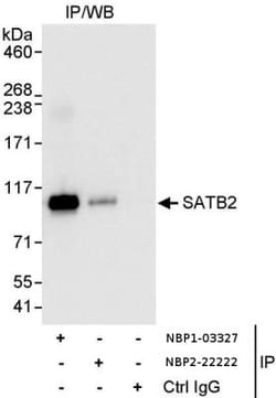 SATB2 Antibody, Novus Biologicals 0.1mL; Unlabeled:Antibodies, Polyclonal