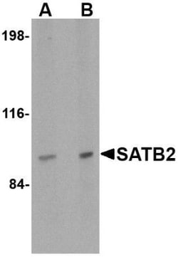 SATB2 Antibody - BSA Free, Novus Biologicals 0.1mg; Unlabeled:Antibodies,