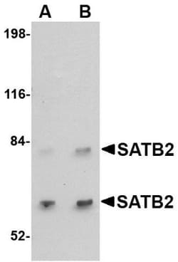 SATB2 Antibody - BSA Free, Novus Biologicals 0.025 mg, Unconjugated:Anticuerpos