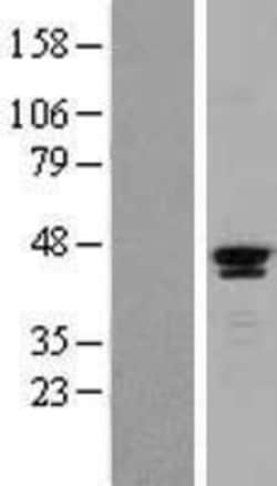 Novus Biologicals&trade;&nbsp;SAV1 Overexpression Lysate