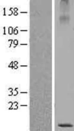 Novus Biologicals&trade;&nbsp;SBEM Overexpression Lysate
