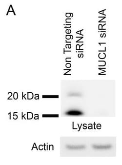 SBEM Antibody, Novus Biologicals 0.1mL; Unlabeled:Antibodies, Polyclonal