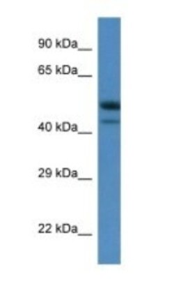 SBK1 Antibody, Novus Biologicals:Antibodies:Primary Antibodies