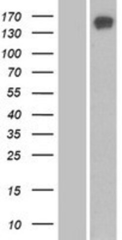 Novus Biologicals™ SBNO1 Overexpression Lysate