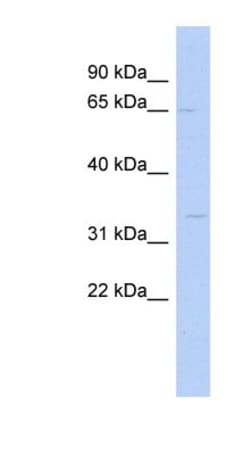 SC5DL Antibody, Novus Biologicals 0.05mg; Unlabeled:Antibodies, Polyclonal