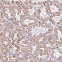 SCA31 Antibody, Novus Biologicals 0.1mL; Unlabeled:Antibodies, Polyclonal