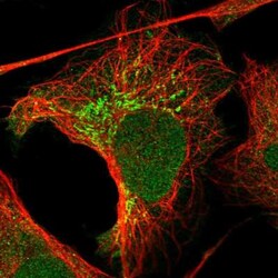 SCAF1 Antibody, Novus Biologicals 25 &mu;L | Buy Online | Novus Biologicals | Fisher Scientific