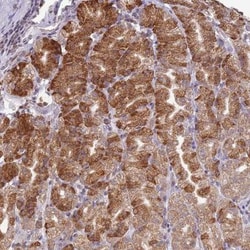 SCAF1 Antibody, Novus Biologicals 25 &mu;L | Buy Online | Novus Biologicals | Fisher Scientific