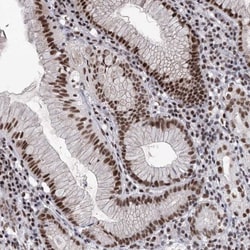 SCAF8/RBM16 Antibody, Novus Biologicals 0.1mL; Unlabeled:Antibodies, Polyclonal