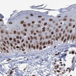 SCAF8/RBM16 Antibody, Novus Biologicals 0.1mL; Unlabeled:Antibodies, Polyclonal