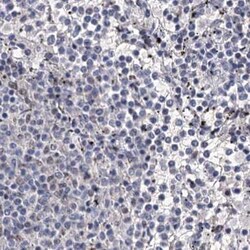 SCAF8/RBM16 Antibody, Novus Biologicals 0.1mL; Unlabeled:Antibodies, Polyclonal