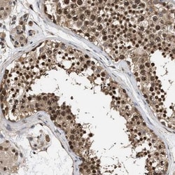 DNMT3B Antibody, Novus Biologicals:Antibodies:Primary Antibodies