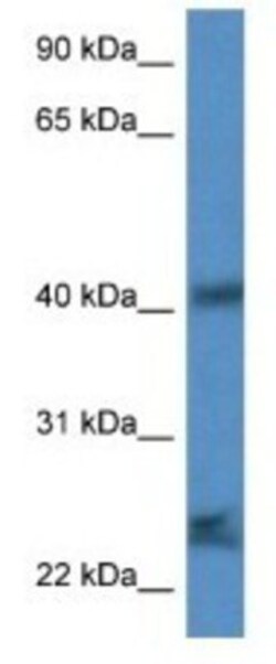 SCAMP1 Antibody, Novus Biologicals:Antibodies:Primary Antibodies