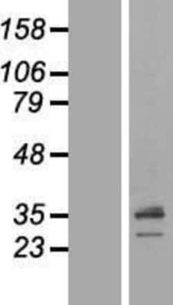 Novus Biologicals™ SCAMP1 Overexpression Lysate