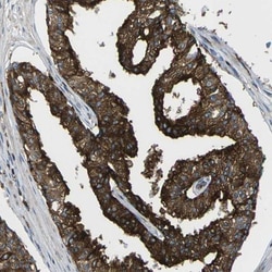 SCAMP2 Antibody, Novus Biologicals 25 &mu;L; Unlabeled:Antibodies, Polyclonal
