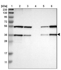 SCAMP2 Antibody, Novus Biologicals 25 &mu;L; Unlabeled:Antibodies, Polyclonal