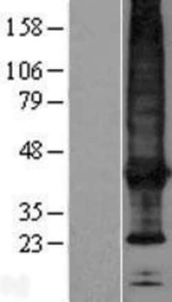 Novus Biologicals&trade;&nbsp;SCAMP4 Overexpression Lysate