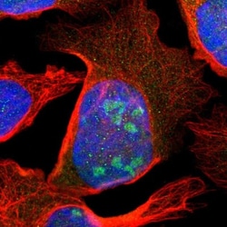 SCAND3 Antibody, Novus Biologicals:Antibodies:Primary Antibodies